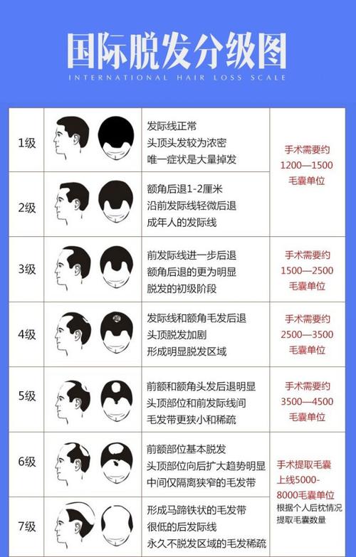 植发需要多少钱