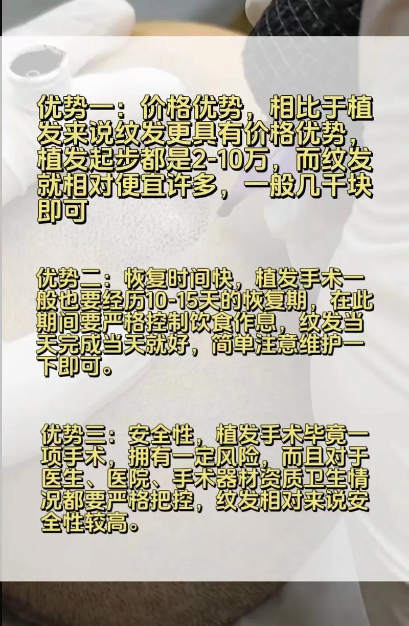 纹发大概得多少钱有植发贵么